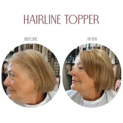 Hairline Band – Limited Stock, Upgrade Your Look Today! 🔥