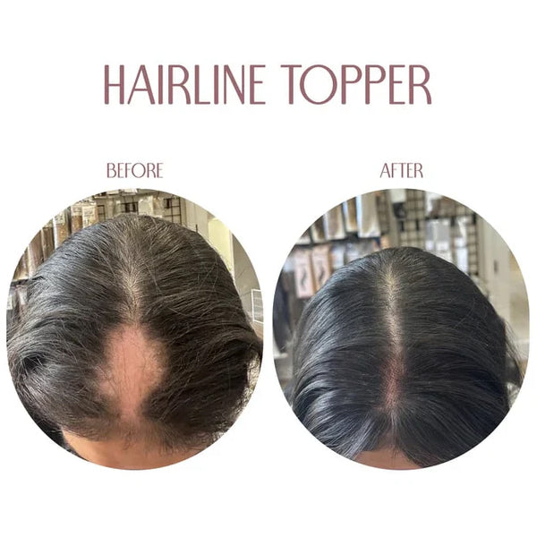 Hairline Band – Limited Stock, Upgrade Your Look Today! 🔥